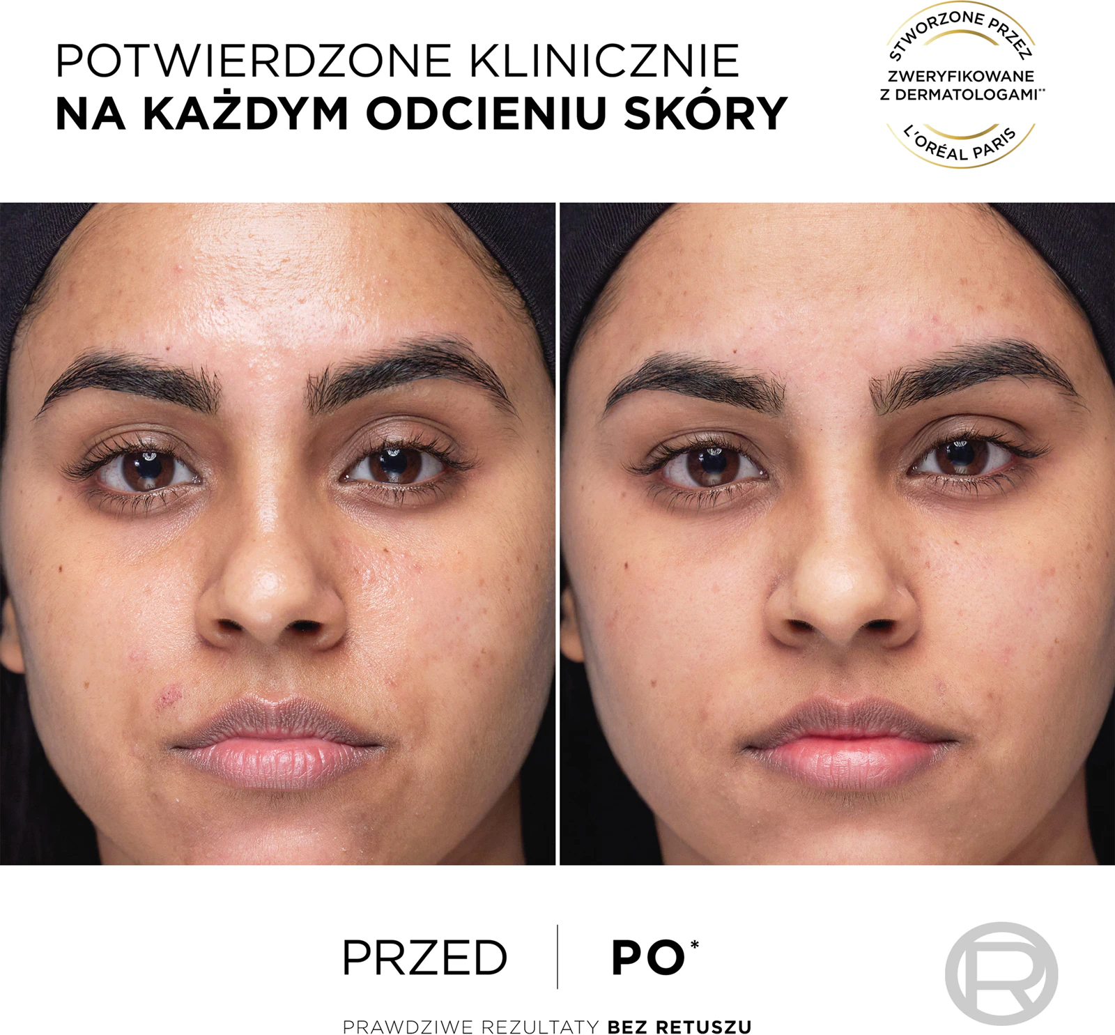 Loreal Revitalift serum na rozszerzone pory