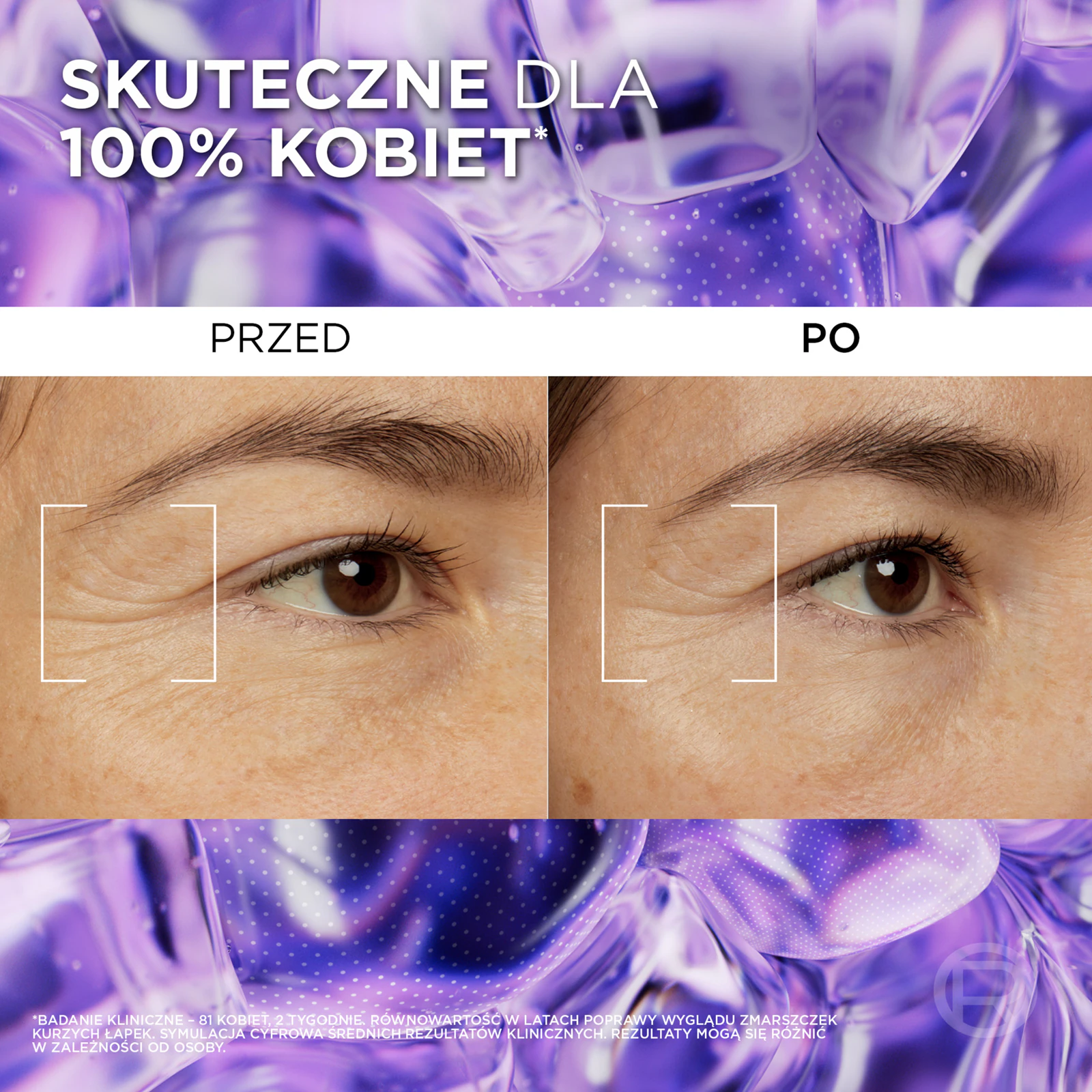 serum z kwasem hialuronowym pod suche oczy