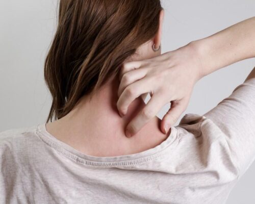 Atopowe zapalenie skóry – sprawdź, czy ten problem dotyczy Ciebie