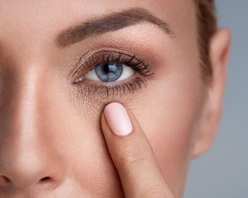 Cienie pod oczami? Sprawdź, jak się ich pozbyć