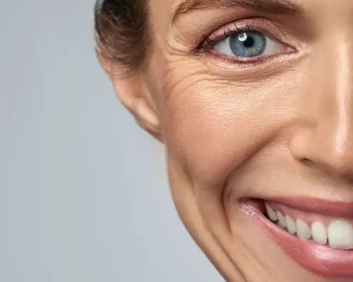 Jak spłycić zmarszczki mimiczne i poprawić wygląd skóry?