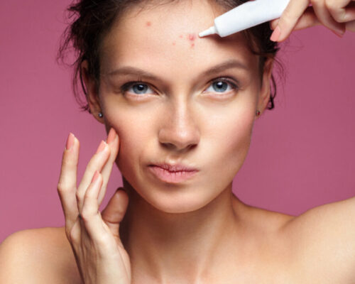 Jak walczyć z pojedynczymi wypryskami domowymi sposobami?