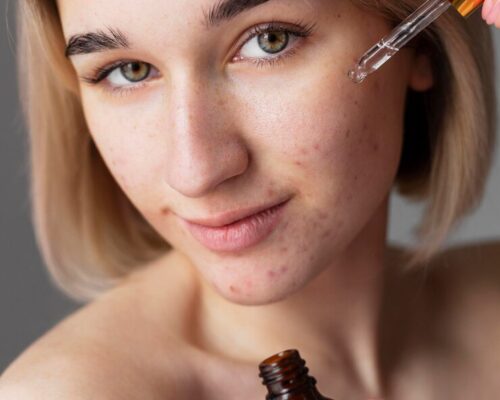 Kwas salicylowy w pielęgnacji skóry trądzikowej – dlaczego warto po niego sięgnąć?