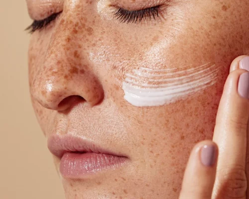 Najlepszy krem na przebarwienia? Sprawdź nasz ranking