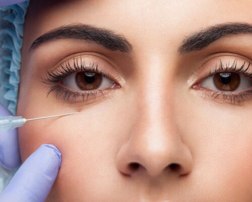 Profesjonalne zabiegi na cienie pod oczami – co naprawdę działa?