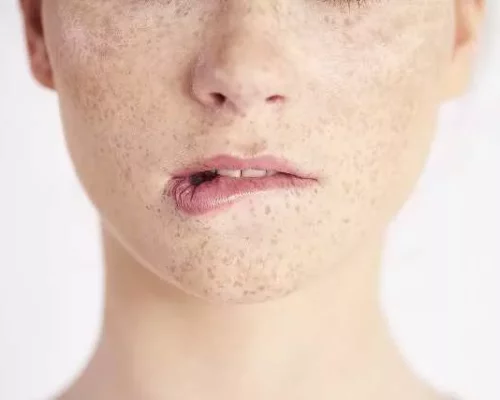 Jak zapobiegać wysychaniu ust – skuteczne nawyki i codzienna pielęgnacja