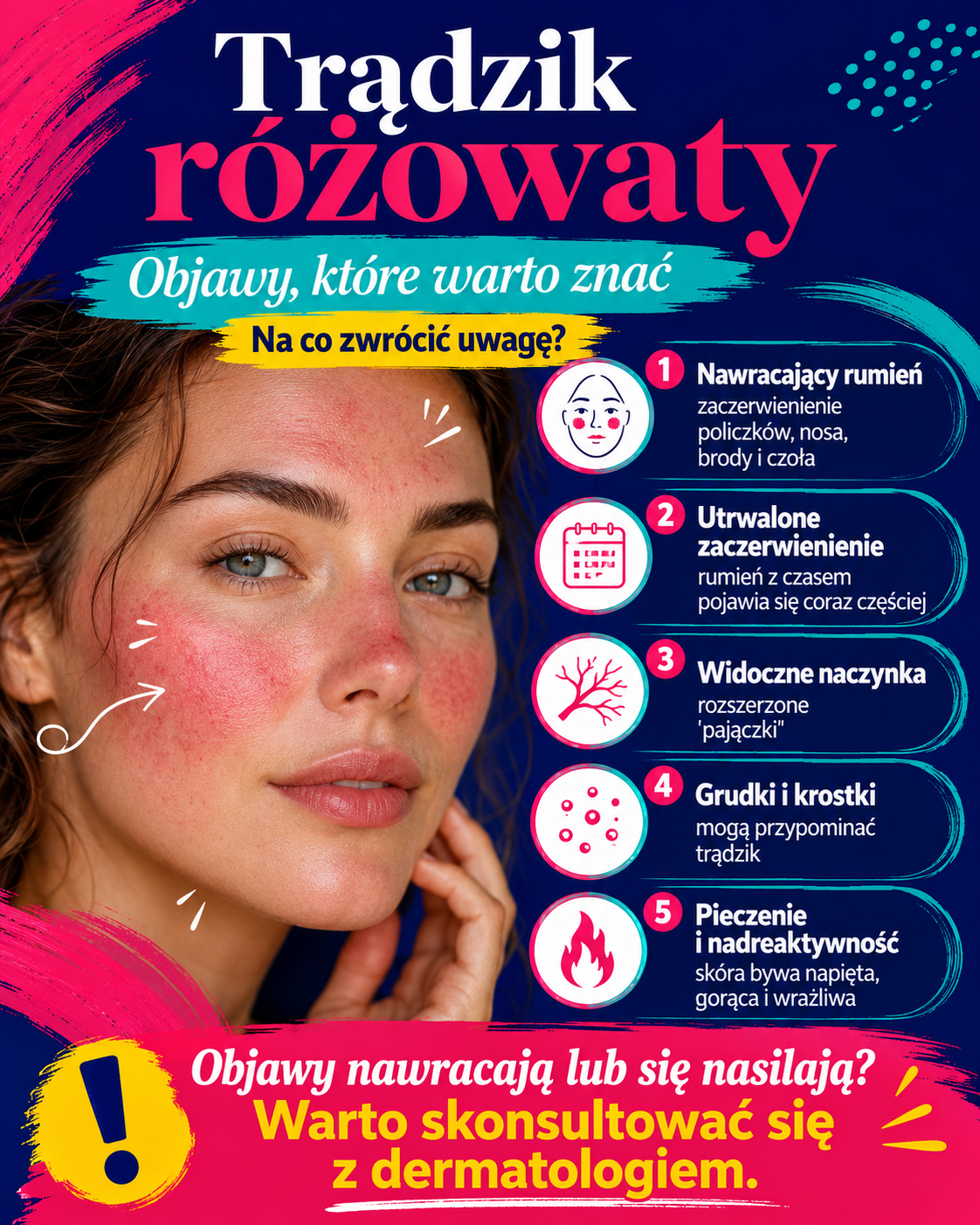 objawy tradziku rozowatego Objawy trądziku różowatego – nawracający rumień, widoczne naczynka, grudki, krostki i pieczenie skóry