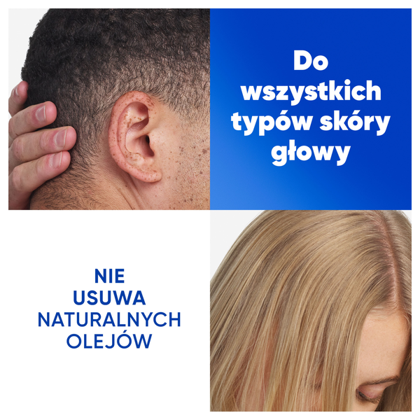 szampon na łupież i swędzącą skórę głowy