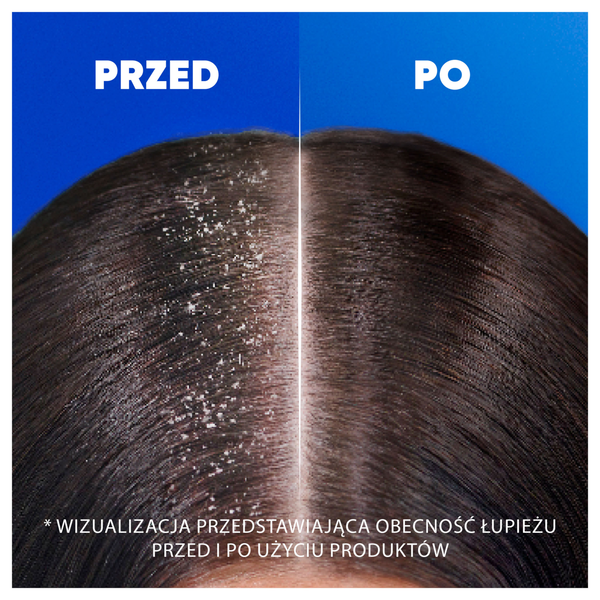Head Shoulders Classic Clean szampon przeciwłupieżowy