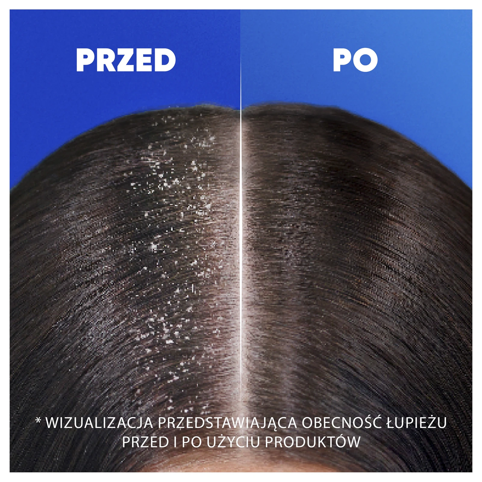 Head Shoulders Menthol Fresh szampon przeciwłupieżowy