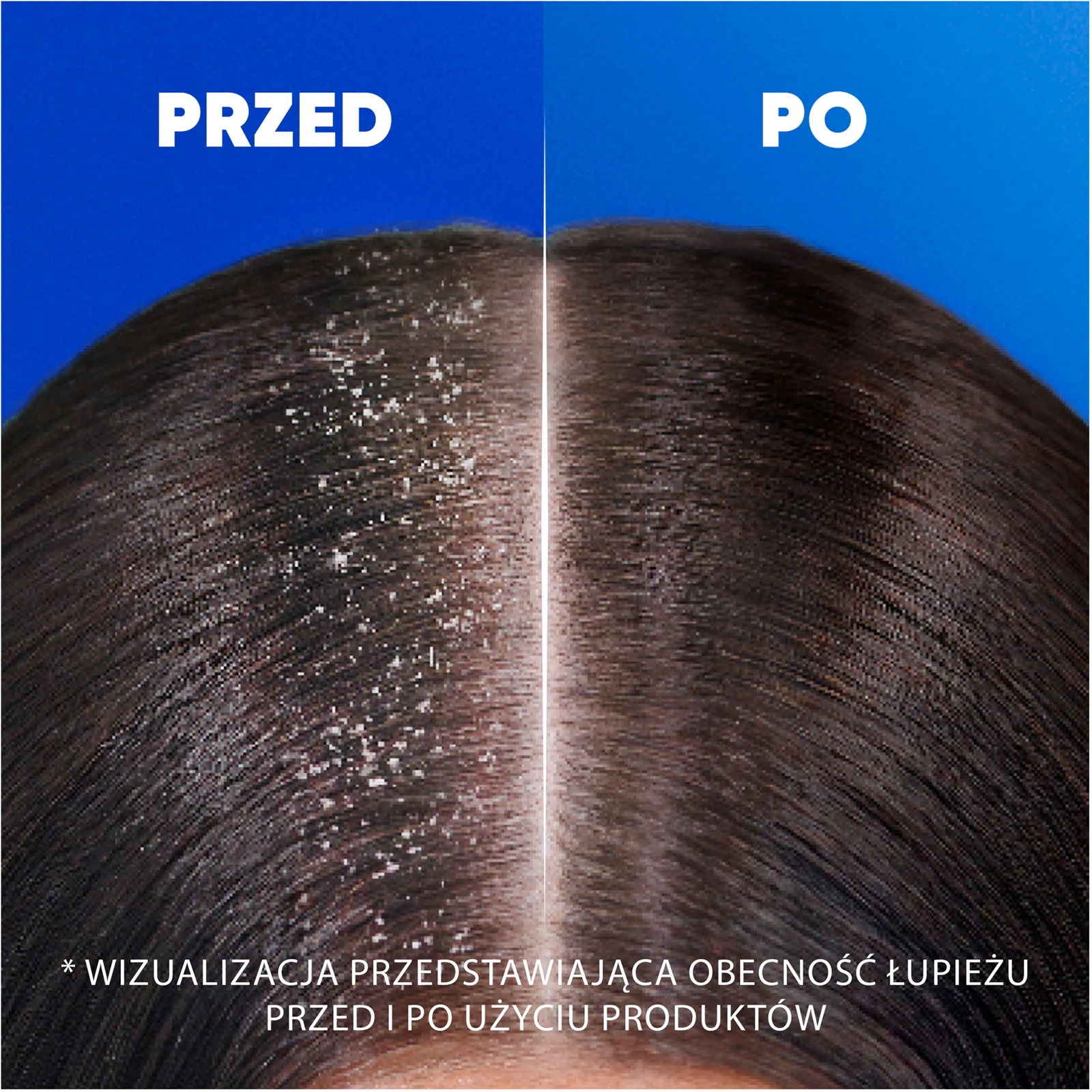 Przeciwłupieżowy szampon do włosów przetłuszczających się Head & Shoulders Citrus Fresh - obrazek 7