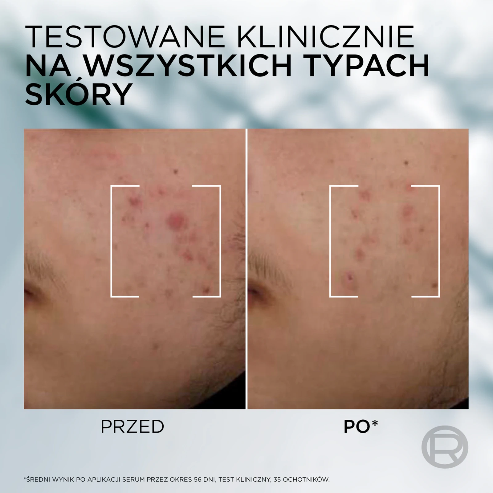 serum do cery tłustej dla mężczyzn