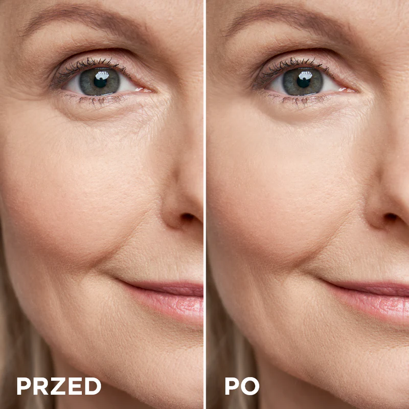 lekki krem pod oczy na opuchnięcia i linie